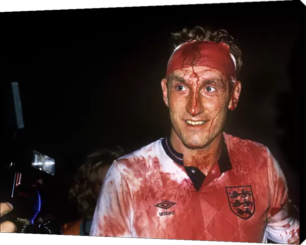 Terry Butcher covered in blood after Englands draw with Sweden in 1989
