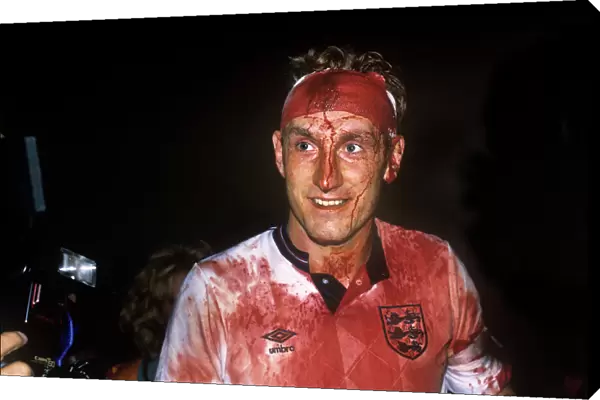 Terry Butcher covered in blood after Englands draw with Sweden in 1989