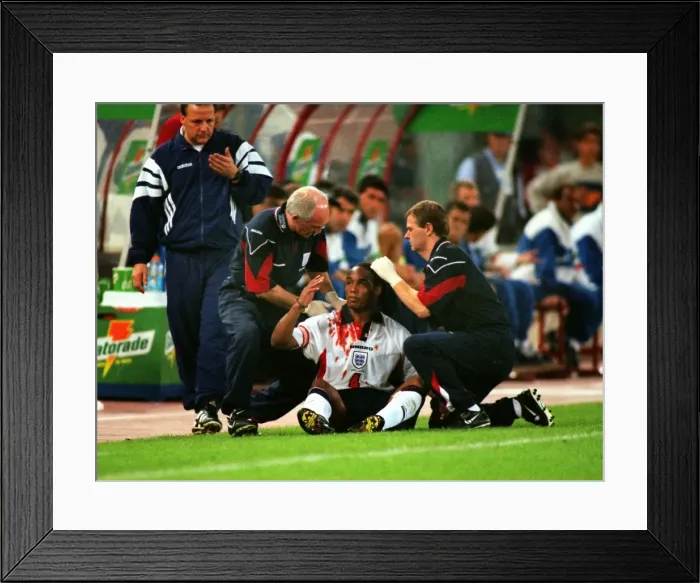 Framed Print : A bloodied Paul Ince during Englands famous draw with Italy in Rome in 1998