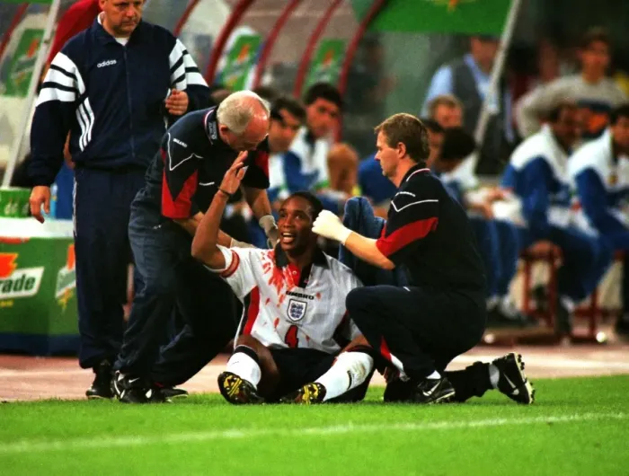 Framed Print : A bloodied Paul Ince during Englands famous draw with Italy in Rome in 1998