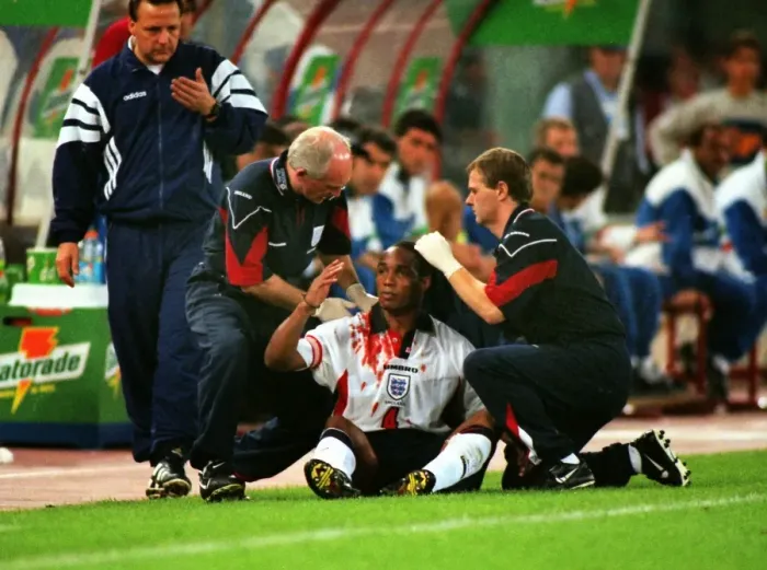 Framed Print : A bloodied Paul Ince during Englands famous draw with Italy in Rome in 1998