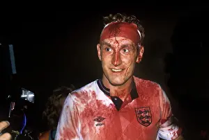 Terry Butcher covered in blood after Englands draw with Sweden in 1989