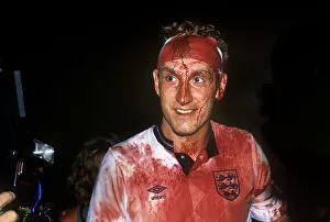 Images Dated 14th April 2010: Terry Butcher covered in blood after Englands draw with Sweden in 1989